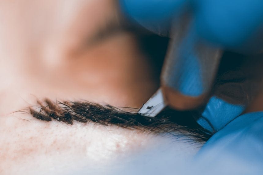 The Healing Process Following a Microblading Procedure