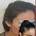Before and after women's micropigmentation The Woodlands TX